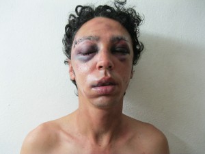 Mario José Delgado González after he was beaten